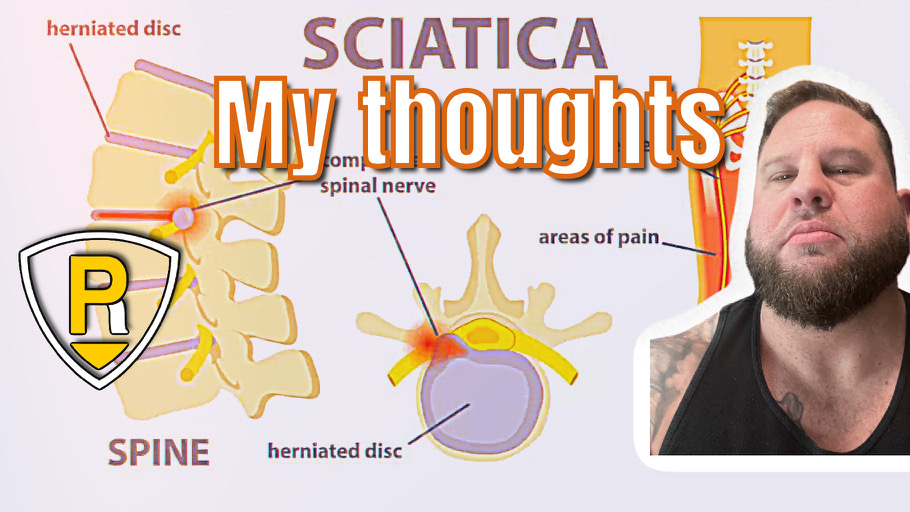 sciatic-nerve-pain