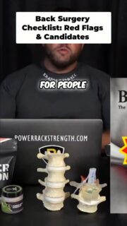 Surgery is a serious decision, and it’s not for everyone. There are clear red flags that make someone a surgical candidate, including cauda equina symptoms, loss of bladder or bowel control, drop foot, unexplained fever with severe pubic pain, or unrelenting pain that lives below the waist and never lets up. In major traumatic cases, like severe car accidents where the pelvis or spine is structurally compromised, surgery may be unavoidable.

For most people, though, spinal issues come from cumulative wear and tear, not trauma. If you have periods where symptoms calm down or pain is reduced, surgery often isn’t the best first option. That usually predicts poorer outcomes. There are exceptions, especially when symptoms are purely radiating and the correct level is clearly identified. In those cases, procedures like a microdiscectomy can reduce nerve pain, but they’re unlikely to fully resolve back pain itself.

This is about knowing who surgery is truly for and what it can — and can’t — fix.

To watch the full video, click the link below, the link in bio, or the link on my story!

https://youtu.be/oQ—a0qhvYM?si=HKF7md9w1kKXQy0b

#backpain #spinesurgery #discbulge #rehab #lowbackpain mcgillmethod backmechanic spinehealth sciatica strengthtraining