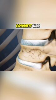 Have you ever met someone whose life was changed by a lift gone wrong?
I have—and more than once.
Most of the time, it didn’t start with recklessness. It started with a squat or a deadlift done without understanding form, bracing, biological limits, or whether that lift even made sense at that time.
A lot of lifters aren’t lazy. They’re traumatized. Every time they step under a bar or onto a platform, the same pain comes back—because no one ever taught them how to stiffen, how to cue, or how to build capacity before loading intensity.
Some people can return to lifts like the deadlift after injury—with the right modifications, patience, and core endurance. Some can’t. That’s reality. Intelligent training means knowing the difference, respecting timelines, and putting longevity before ego.
👉 To watch the full video, click the link below or the link on my story!
https://www.youtube.com/watch?v=hjAEpJ3170o
#SquatLongevity #BackPainEducation #TrainSmart #StrengthCoaching #InjuryPrevention