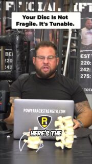 A disc bulge, herniation, annular tear, extrusion, or sequestered fragment is not a death sentence.
These terms sound scary when you read them on an MRI report, but they are only descriptions. They do not automatically tell you why you hurt, what movements are triggering your pain, or what needs to be done to fix it.
I want to know what the assessment shows. Does flexion bother you? Extension? Compression? Shear? Do symptoms travel down the leg? Does the disc change dynamically under load or position?
The MRI matters, but it is not the whole story. We treat the person in front of us, not just the picture on the screen.
To watch the full video, click the link below, the link on my Instagram story, or the link in my bio.
https://www.powerrackstrength.com/disc-injuries-are-not-a-death-sentence/
#DiscInjury #BackPain #McGillMethod #SpineHealth #PowerRackStrength
