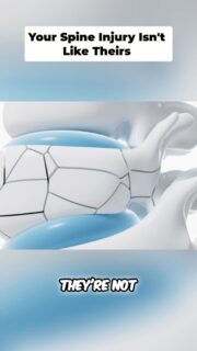 Not all spine injuries are the same.
Just because your MRI says “disc bulge,” “herniation,” or “degeneration” does not mean you have the same injury as your coach, your friend, or someone else you saw online.
The label matters, but the mechanism matters more.
What movements trigger your pain? What stress is being repeated every day? Is it flexion, compression, twisting, fatigue, or a combination of all of it?
That is why assessment comes first. Without understanding the mechanism, you are just guessing.
To watch the full video, click the link below, the link in bio, or the link on my story!
https://www.powerrackstrength.com/spine-injuries-are-not-all-the-same/
#BackPain #SpineHealth #DiscHerniation #McGillMethod #PowerRackStrength