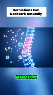 Healing a disc injury is not about finding a magic stretch, injection, adjustment, or quick fix.
The first step is identifying what is actually triggering your pain and removing it. From there, you have to calm the irritation, improve your movement and spine hygiene, build stability, and gradually restore your capacity to tolerate load.
Feeling better does not always mean the disc is fully healed. The tissue still needs time to adapt, stiffen, and become resilient again. If you rush back into heavy training as soon as the pain decreases, you can end up repeating the same cycle every few months.
You do not heal your back by doing as much as possible. You heal it by doing as much as necessary, following the right process, and respecting biology.
To watch the full video, click the link below, the link in bio, or the link on my story!
https://www.powerrackstrength.com/how-to-heal-a-disc-injury-stop-guessing-and-respect-the-process/
#DiscInjury #DiscHerniation #BackPain #LowBackPain #SpineHealth