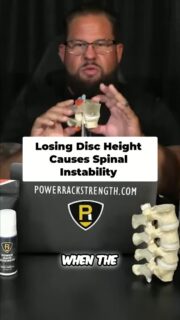 Pain does not always show up where the actual problem begins.
You may feel pain in your foot and assume it is plantar fasciitis. Your hamstring, glute, or leg may be burning, so you assume it is a local muscle issue or sciatica.
But in many cases, those symptoms can be connected to irritation or injury around the lower lumbar spine, particularly the L4-L5 or L5-S1 segments.
The good news is that a disc herniation does not automatically mean you need to panic or rush into an aggressive intervention. In certain cases, the body’s natural inflammatory response can gradually break down and absorb herniated or sequestered disc material over time.
That does not mean every case should simply be ignored. It means the location of your pain does not always reveal the true source, and an alarming MRI does not always determine your long-term outcome.
You need to understand the mechanism, allow the area to settle when appropriate, and build your recovery plan around what is actually driving the symptoms.
To watch the full video, click the link below, the link in bio, or the link on my story!
https://www.youtube.com/watch?v=_Q807aHTMYo
#BackPain #DiscHerniation #Sciatica #SpineHealth #PowerRackStrength